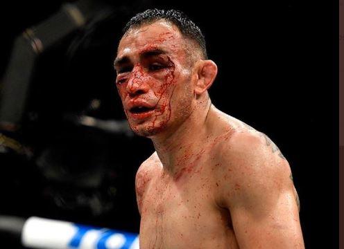 UFC